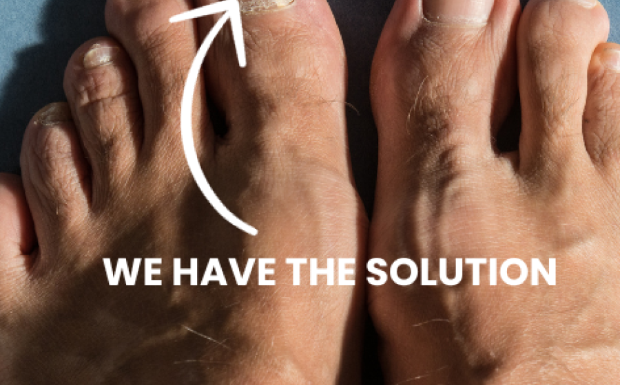 Bid Farewell to Toenail Fungus from the Comfort of Your Home