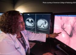 Medicare Now Covers Less Invasive Colorectal Cancer Tests 